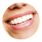 Sydney dental implants - Dr Paulo Pinho.jpg