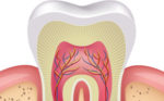 Wisdom Teeth Removal Blacktown - Westpoint Dental Clinic.jpg