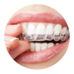 Cheap dental implants sydney - Dr Paulo Pinho.jpg